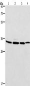 MAD2L1 Binding Protein antibody, TA349386, Origene, Western Blot image 