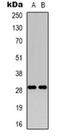 Ras-related protein Rab-34 antibody, orb318903, Biorbyt, Western Blot image 
