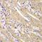 Endoplasmic reticulum-Golgi intermediate compartment protein 2 antibody, GTX55607, GeneTex, Immunohistochemistry paraffin image 