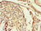 Distal-Less Homeobox 5 antibody, orb41741, Biorbyt, Immunohistochemistry paraffin image 