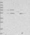Zinc Finger And BTB Domain Containing 3 antibody, NBP1-82079, Novus Biologicals, Western Blot image 
