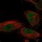 Homeobox protein Nkx-6.1 antibody, HPA036774, Atlas Antibodies, Immunofluorescence image 