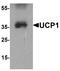 Uncoupling Protein 1 antibody, TA326708, Origene, Western Blot image 