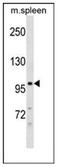Desmocollin 3 antibody, AP51323PU-N, Origene, Western Blot image 