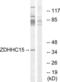 Zinc Finger DHHC-Type Containing 15 antibody, LS-C120191, Lifespan Biosciences, Western Blot image 