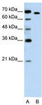 Nuclear receptor ROR-alpha antibody, TA337925, Origene, Western Blot image 