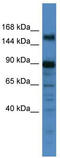 Pogo Transposable Element Derived With ZNF Domain antibody, TA343770, Origene, Western Blot image 