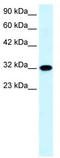 Aquaporin-7 antibody, TA331176, Origene, Western Blot image 
