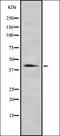 NIMA Related Kinase 6 antibody, orb337140, Biorbyt, Western Blot image 