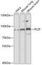 Zinc Finger And BTB Domain Containing 16 antibody, GTX33417, GeneTex, Western Blot image 