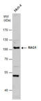 Recombination Activating 1 antibody, GTX132124, GeneTex, Western Blot image 