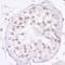 FGR Proto-Oncogene, Src Family Tyrosine Kinase antibody, A300-346A, Bethyl Labs, Immunohistochemistry paraffin image 