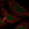 Centromere Protein C antibody, NBP2-55474, Novus Biologicals, Immunocytochemistry image 