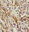 Nudix Hydrolase 1 antibody, FNab05400, FineTest, Immunohistochemistry paraffin image 