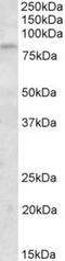Kelch Like Family Member 6 antibody, TA311566, Origene, Western Blot image 