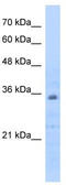 BAP antibody, TA346614, Origene, Western Blot image 
