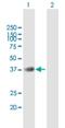 Beta-1,4-Galactosyltransferase 7 antibody, H00011285-B01P, Novus Biologicals, Western Blot image 