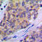Phospholipase A2 Group IVA antibody, LS-C354045, Lifespan Biosciences, Immunohistochemistry paraffin image 