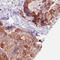 Long-chain-fatty-acid--CoA ligase 5 antibody, AMAb90634, Atlas Antibodies, Immunohistochemistry frozen image 