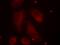 LIM Domain Kinase 1 antibody, GTX50187, GeneTex, Immunofluorescence image 