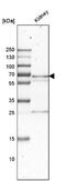Phosphoenolpyruvate carboxylase antibody, NBP1-80927, Novus Biologicals, Western Blot image 