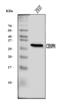 Centromere Protein H antibody, A06302-3, Boster Biological Technology, Western Blot image 
