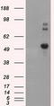 Nucleotide exchange factor SIL1 antibody, TA500997, Origene, Western Blot image 