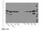 Potassium voltage-gated channel subfamily A member 2 antibody, 14235-1-AP, Proteintech Group, Western Blot image 