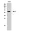 5-Hydroxytryptamine Receptor 6 antibody, A11122-1, Boster Biological Technology, Western Blot image 
