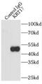 Keratin-17 antibody, FNab02203, FineTest, Immunoprecipitation image 