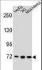 Zinc Finger Protein 860 antibody, LS-C160960, Lifespan Biosciences, Western Blot image 