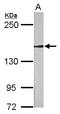 RAD50 Double Strand Break Repair Protein antibody, LS-C155764, Lifespan Biosciences, Western Blot image 