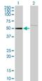 Zinc Finger Protein 92 antibody, H00168374-M01, Novus Biologicals, Western Blot image 