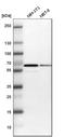 Beta-1,4-N-Acetyl-Galactosaminyltransferase 1 antibody, HPA008968, Atlas Antibodies, Western Blot image 