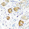 N-Sulfoglucosamine Sulfohydrolase antibody, A04608, Boster Biological Technology, Immunohistochemistry paraffin image 