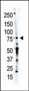 ECPTP antibody, AP15214PU-N, Origene, Western Blot image 