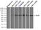 Solute Carrier Family 2 Member 5 antibody, NBP2-71285, Novus Biologicals, Immunoprecipitation image 