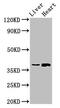 Aminocarboxymuconate Semialdehyde Decarboxylase antibody, CSB-PA851554LA01HU, Cusabio, Western Blot image 