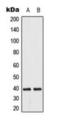 Dual Specificity Phosphatase 14 antibody, orb224163, Biorbyt, Western Blot image 