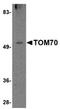 Translocase Of Outer Mitochondrial Membrane 70 antibody, orb75112, Biorbyt, Western Blot image 