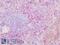 C-C Motif Chemokine Receptor 4 antibody, LS-A351, Lifespan Biosciences, Immunohistochemistry frozen image 