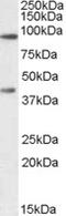 ATP Binding Cassette Subfamily B Member 5 antibody, EB08211, Everest Biotech, Western Blot image 