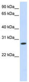 Hydroxysteroid 11-Beta Dehydrogenase 1 antibody, TA338149, Origene, Western Blot image 
