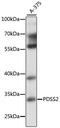 Decaprenyl-diphosphate synthase subunit 2 antibody, 16-656, ProSci, Western Blot image 
