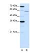NOVA Alternative Splicing Regulator 2 antibody, NBP1-57296, Novus Biologicals, Western Blot image 