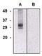 Chloride intracellular channel protein 5 antibody, AM26766PU-N, Origene, Western Blot image 