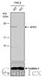 Cyclic AMP-dependent transcription factor ATF-3 antibody, GTX129120, GeneTex, Western Blot image 
