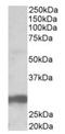 V-Set Domain Containing T Cell Activation Inhibitor 1 antibody, orb19600, Biorbyt, Western Blot image 