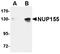 Nucleoporin 155 antibody, orb75028, Biorbyt, Western Blot image 