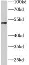 Zinc finger protein AEBP2 antibody, FNab00187, FineTest, Western Blot image 
